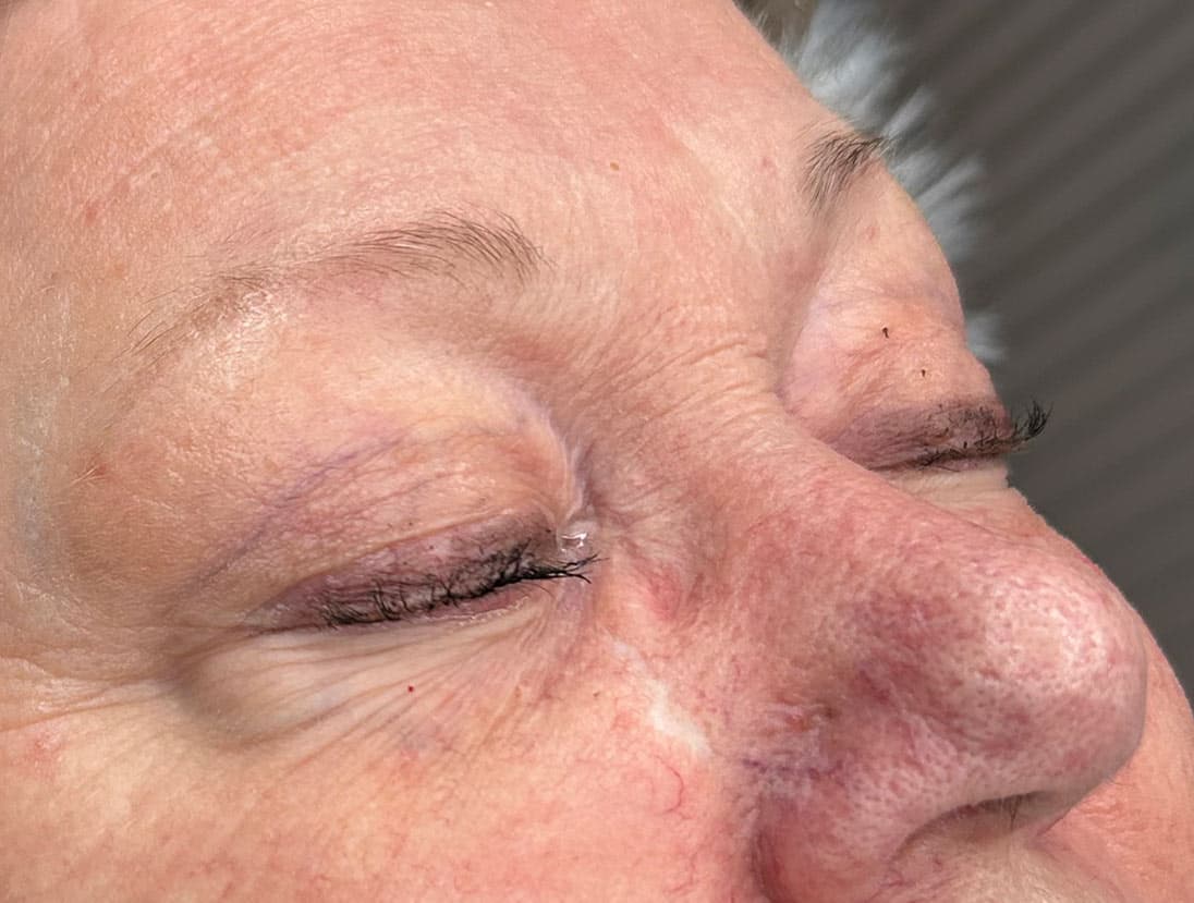 Nano hairstroke PMU behandeling resultaat Brow Vision — voor